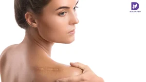 کرم ترمیم کننده جای زخم